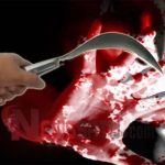 Diserang Orang Tak Dikenal, Tangan Warga Kepulauan Kangean Nyaris Putus
