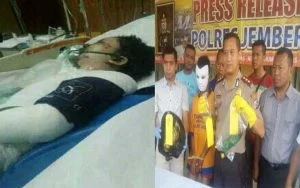 Dibakar Api Cemburu, Suami Tega Bakar Istri Sirrinya