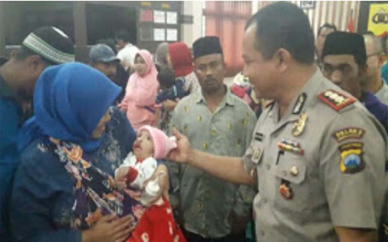 Polres Probolinggo Gelar Bakti Sosial Operasi Bibir Sumbing