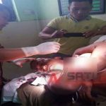 Diduga Perselingkuhan Warga Sumenep Dibacok