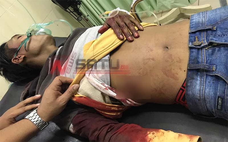Melawan Polisi, Seorang Residevis Di Sumenep Ditembak Mati