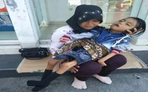 Bocah 10 Tahun Di Banyumas Menderita Polio