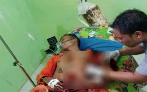 Tiga Orang Kritis, Warga Kangean Sumenep Terlibat Carok