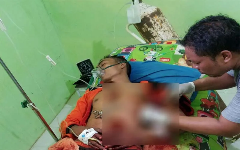 Tiga Orang Kritis, Warga Kangean Sumenep Terlibat Carok
