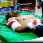Warga Banyuwangi Jadi Korban Begal Di Probolinggo