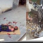 Warga Pamekasan Terkena Ledakan Petasan Saat Naik Motor