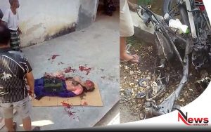 Warga Pamekasan Terkena Ledakan Petasan Saat Naik Motor