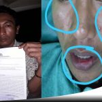 Dua Oknum Polisi Diduga Aniaya Pemuda 16 Tahun Di Sumenep