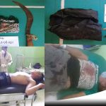 Tiga Warga Kangean Sumenep Terlibat Perkelahian Gunakan Sajam