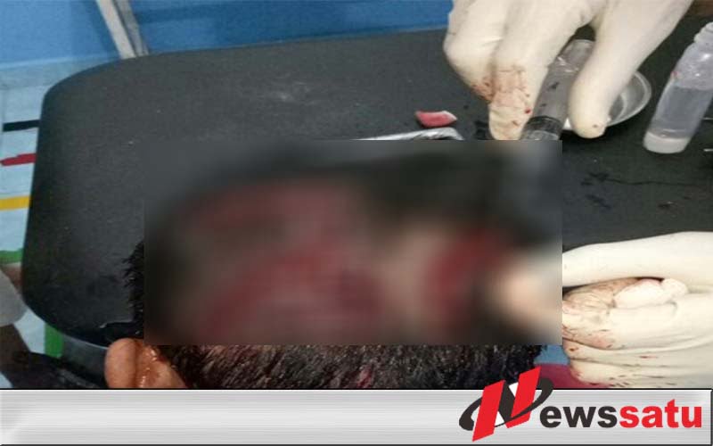 Nekat Curi Mobil, Warga Ogan Komering Ilir Babak Belur Dihajar Massa
