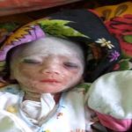 Dibuang di Pemakaman, Bayi Cacat Fisik Bikin Geger Warga Sumenep