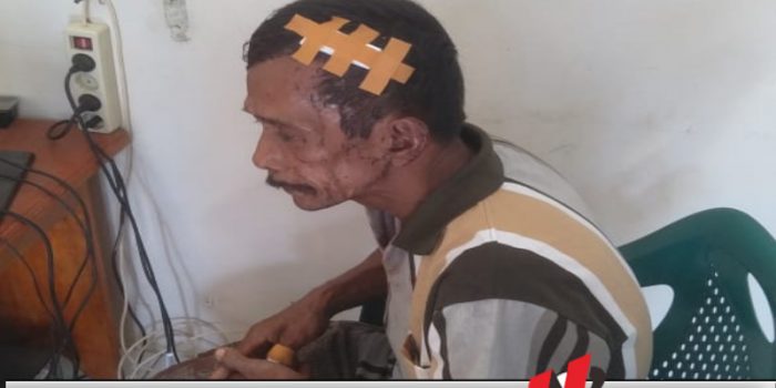 Kasihan, Kakek 62 Tahun di OKI Dirampok dan Dibacok