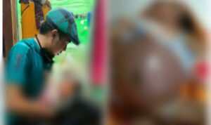 Lahir Tanpa Anus, Bayi di Camplong Memprihatinkan