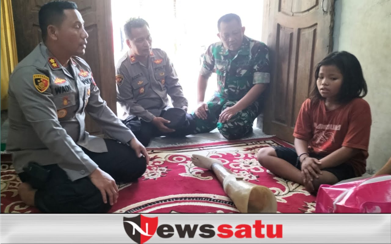 Nasib Gadis Kaki Palsu Jadi Perhatian Kapolres Probolinggo Kota