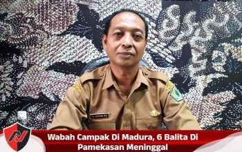 Wabah Campak Di Madura, 6 Balita Di Pamekasan Meninggal